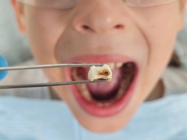 Best Emergency Broken Tooth Repair in Metlatla, AK