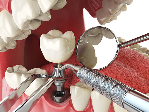 Professional Emergency Dentist in AK